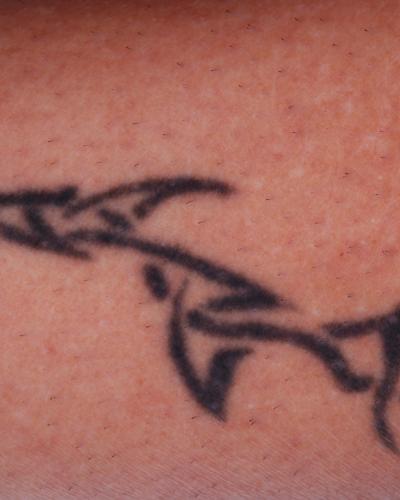 tribal tattoo on skin before removal