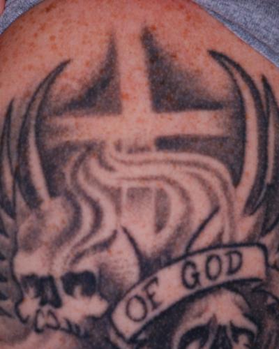 Skull Cross and Bones Tatoo Before It was Removed at Nirvana Medical Spa