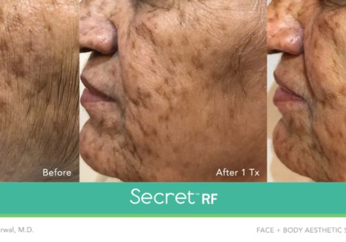 Secret-RF-8-1030x443